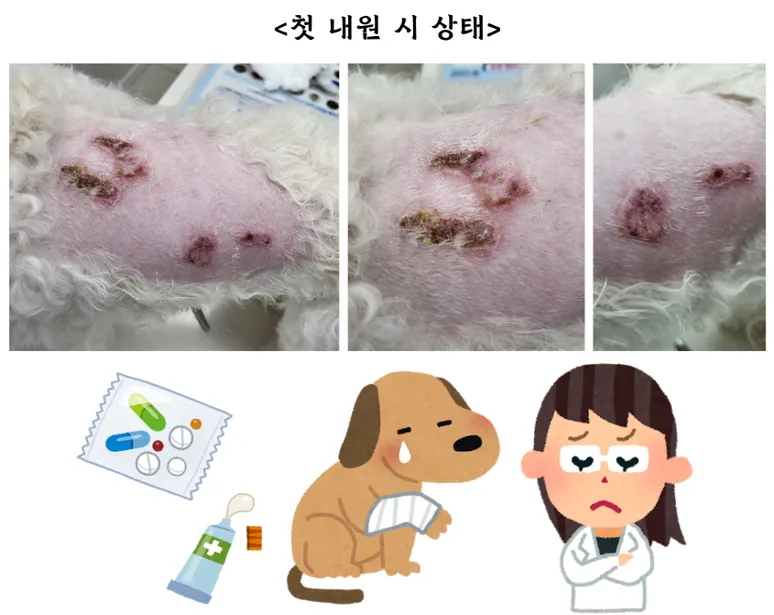 등에 넓은 화상을 입은 헤든이의 레이저 치료 12회