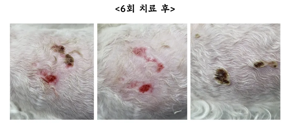 등에 넓은 화상을 입은 헤든이의 레이저 치료 12회 — 진료 사진 3