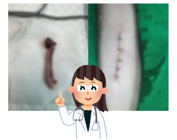 콩팥 하나, 자궁 하나로 태어난 아기 고양이 행복이 — 진료 사진 2