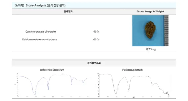구토로 찾아낸 요관결석, 5살 말티즈 기쁨이 이야기 — 진료 사진 5
